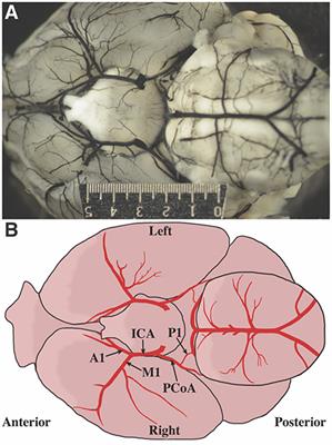 Cerebral Artery Diameter in Inbred Mice Varies as a Function of Strain